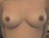Soins malsains pour les seins
