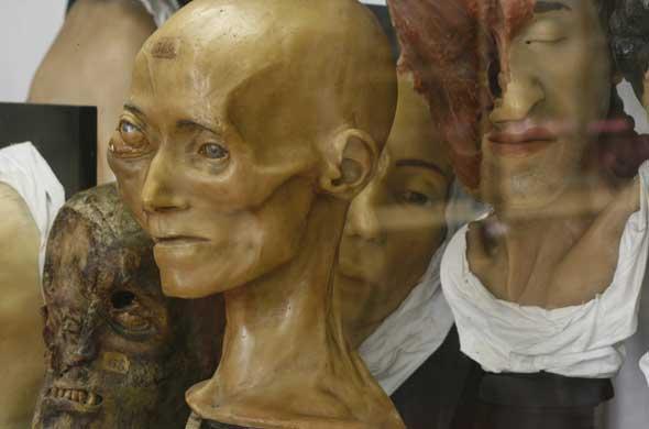 Dupuytren, ou le musée des horreurs