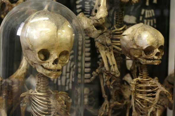 Dupuytren, ou le musée des horreurs