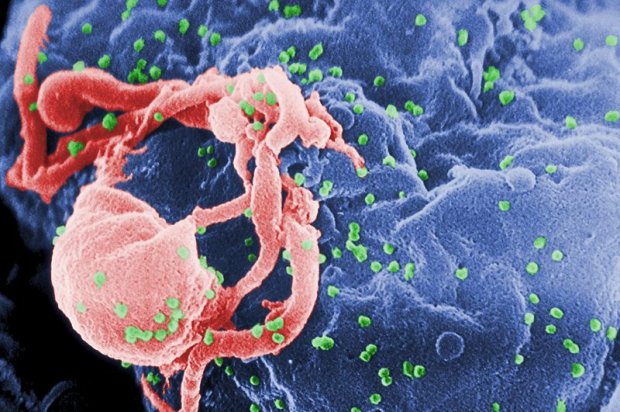 Le Nobel 2008 conforte la paternité française du virus du sida