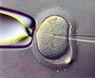Fécondation in vitro : trente ans de bébés éprouvés