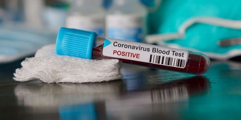 Stratégie de lutte contre le Covid-19 dans une région de l'Est algérien