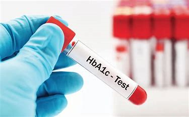 Covid-19 & Les tests diagnostiques. Quelques notions essentielles avec exemples (fiabilité, sensibilité, spécificité, valeurs prédictives)