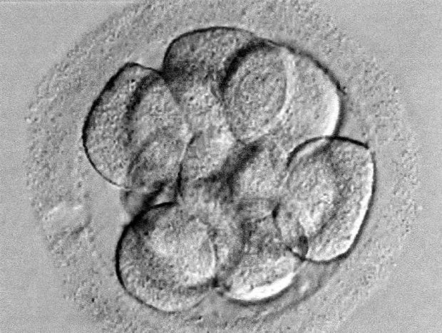 Embryon